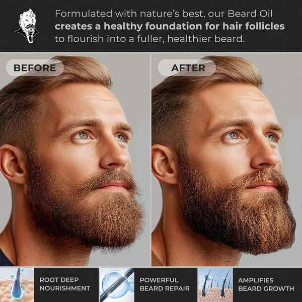 Beard Oil for Men - Hypoallergenic Natural Ingredients for Sensitive Skin, Nut Free Mustache Growth Conditioners, Natural Solution Conditioner to