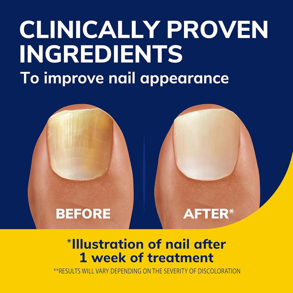 Dr. Scholl'S Fungal Nail Revitalizer Liquid, 10Ml