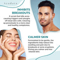 Exfoliating Acne Scrub, 4 Fl Oz(118 Ml), Exfoliating Acne Face Wash, Natural Facial Scrub for Severe and Hormonal Acne, Facial Acne Scrub for