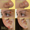 Bodyj4You Piercing Keloid Bump Removal - Natural Oil Piercing Bump Treatment - Nose Septum Belly Ear Cleaner Soothing Skin Recovery Solution -