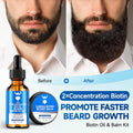 Beard Growth Oil & Beard Balm - Beard Growth Kit with 2X Concentration Biotin for Men, Natural Ingredients with Argan Oil, Jojoba Oil and Vitamin
