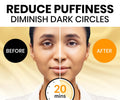 Stylia under Eye Patches for Dark Circles and Puffy Eyes (30 Pairs) - 24K Gold under Eye Mask with Vitamin C, Hyaluronic Acid, Pearl Extract - Eye