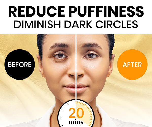Stylia under Eye Patches for Dark Circles and Puffy Eyes (30 Pairs) - 24K Gold under Eye Mask with Vitamin C, Hyaluronic Acid, Pearl Extract - Eye