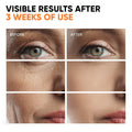 Vitamin C Serum for Face, Stem Cells, Niacinamide, Hyaluronic Acid & Vitamin E – Anti-Aging Retinol Facial Serum with Glycolic Acid & Retinal for