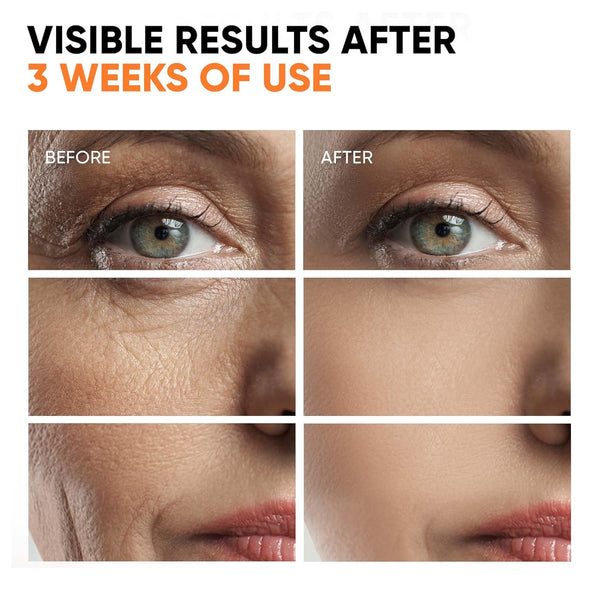 Vitamin C Serum for Face, Stem Cells, Niacinamide, Hyaluronic Acid & Vitamin E – Anti-Aging Retinol Facial Serum with Glycolic Acid & Retinal for