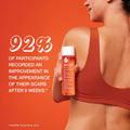 Bio-Oil Skincare Body Oil Serum, Face and Body Moisturizer with Vitamin E & A, for Scars, Stretch Marks, Sensitive Skin, All Skin Types,