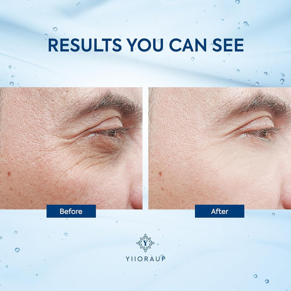 Caffeine Eye Cream for Men: under Eye Roller for Bags and Puffy Eyes Treatment - Men'S Cooling Stick and Depuffer for Dark Circles and Puffiness