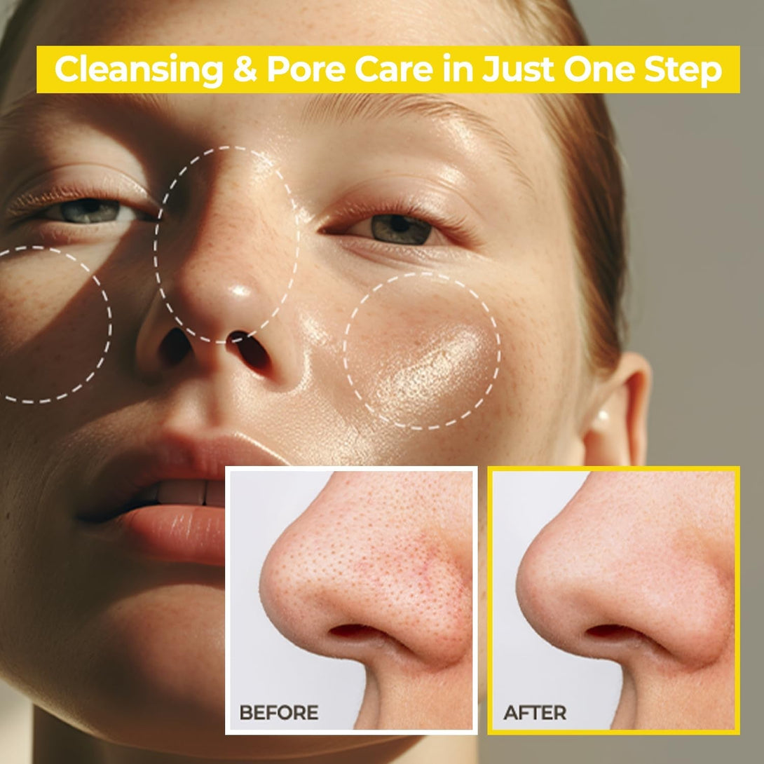 AVCA Korean Blackhead Remover Cleansing Oil 10.14 Fl.Oz.(300Ml) - Oil Cleanser for Face, Makeup Blackhead Remover, Normal & Oily Skin, Face Pore Cleanser