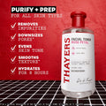 THAYERS Alcohol-Free Rose Petal Witch Hazel Facial Toner for Glowing Skin, Soothing, Hydrating, Refreshing Toner for All Skin Types, 12Oz