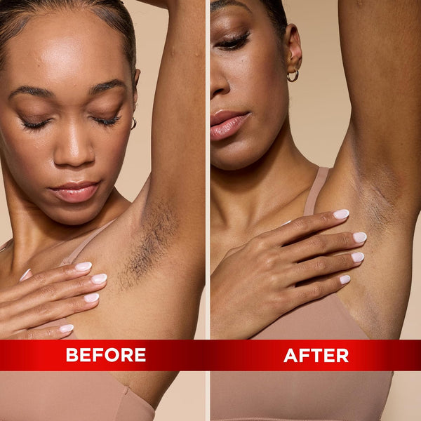 Softsheen-Carson Magic Razorless Shaving Cream, Hair Removal Cream for Body Hair, Extra Strength Depilatory Cream, Works in 4 Minutes for Coarse