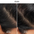 OUAI anti Dandruff Shampoo - Soothing Salicylic Acid Shampoo for Flaky, Dry and Itchy Scalp - Reduces Itching, Redness and Irritation - Sulfate