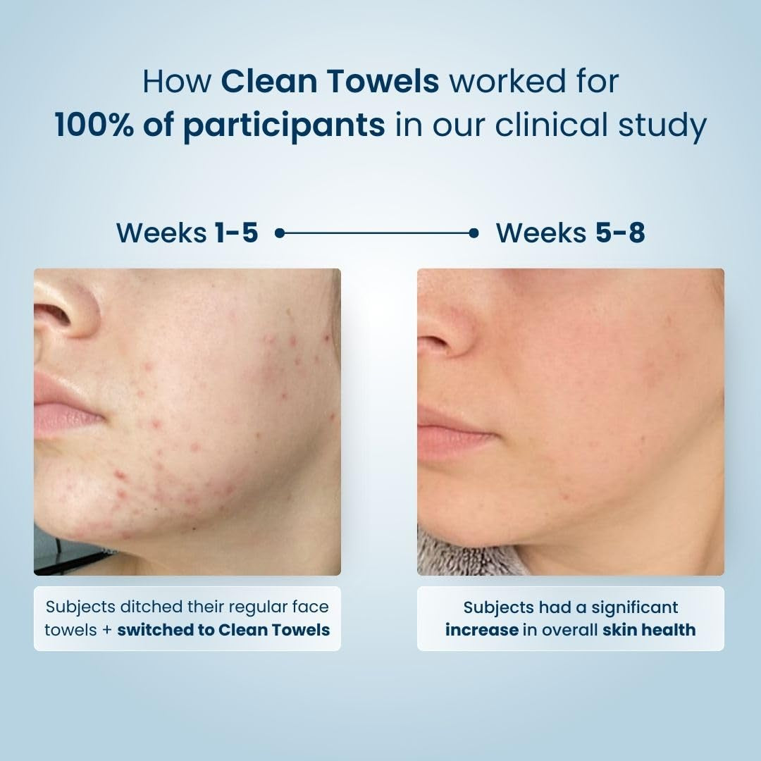 Clean Skin Club Clean Towels™, 100% USDA Biobased Dermatologist Approved Face Towel, Disposable Clinically Tested Face Towelette, Facial Washcloth, Ultra Soft Makeup Remover Dry Wipes, 1 Pack, 25 Ct