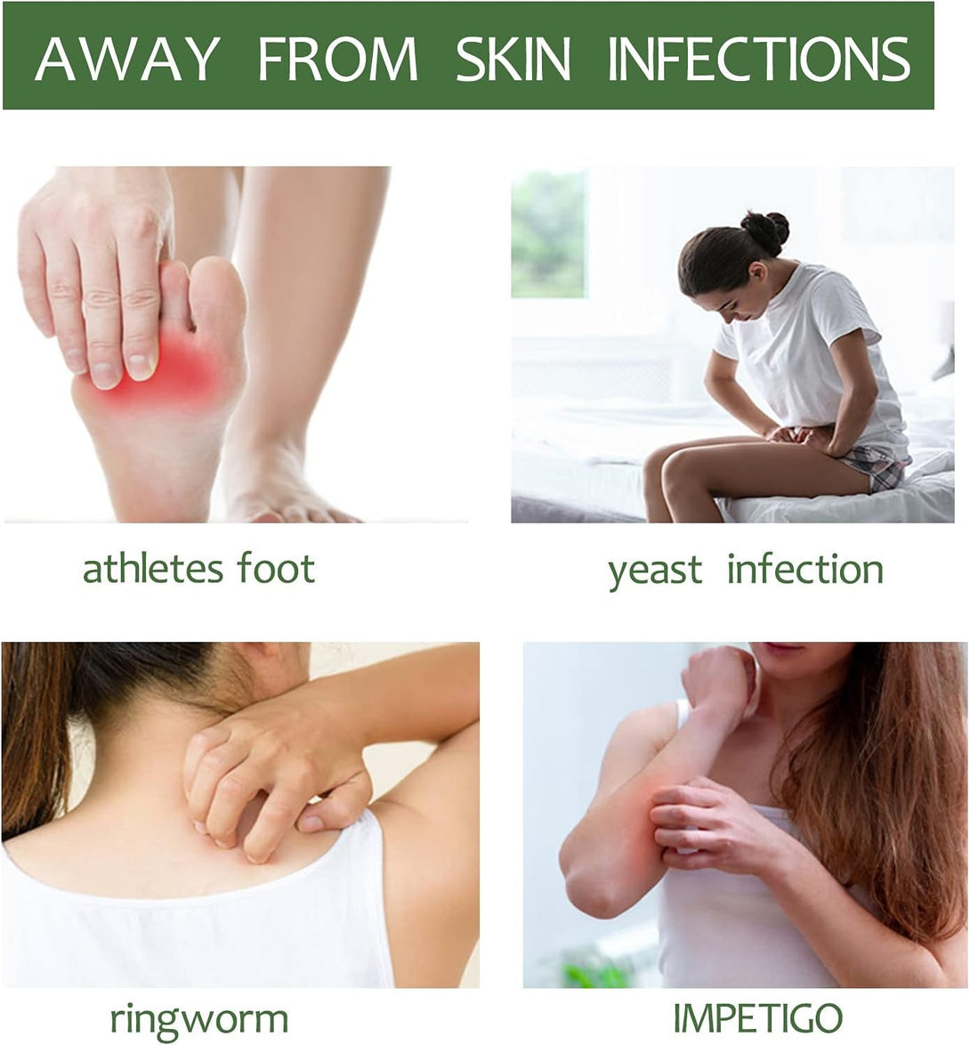 Antifungal Medicated Soap Bar, Athletes Foot Jock Itch Ringworm Yeast Infection Treatment for Men, Tea Tree Oil Body Soap Bar with Natural Tea Tree Oil, Eucalyptus Oil and Lavender Oil, 4 Oz