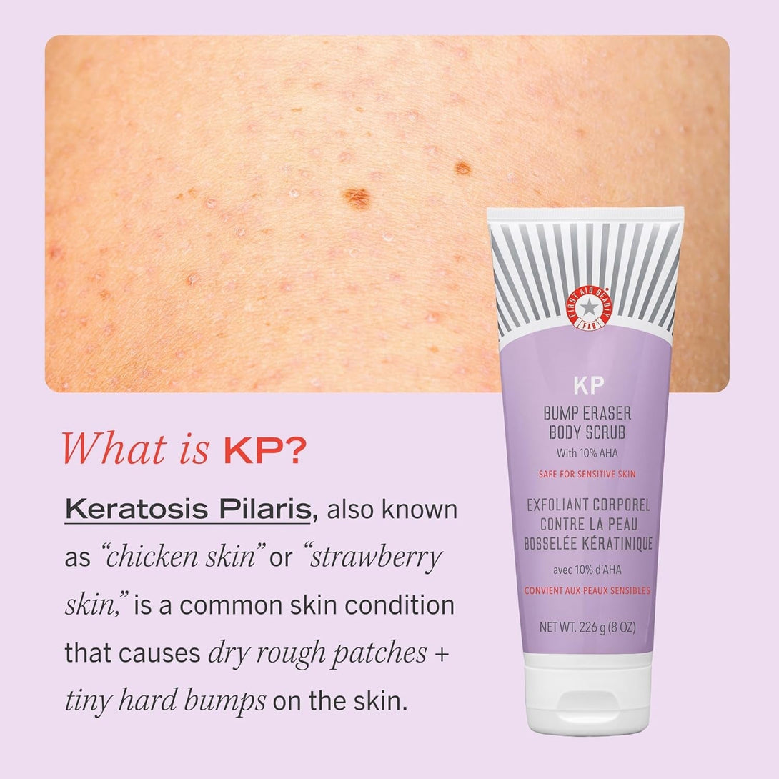 First Aid Beauty - KP Bump Eraser Body Scrub with 10% AHA, Keratosis Pilaris Skin Exfoliator with Glycolic and Lactic Acids, Helps Reduce Chicken Skin Bumps, Safe for Sensitive Skin, 2 Oz