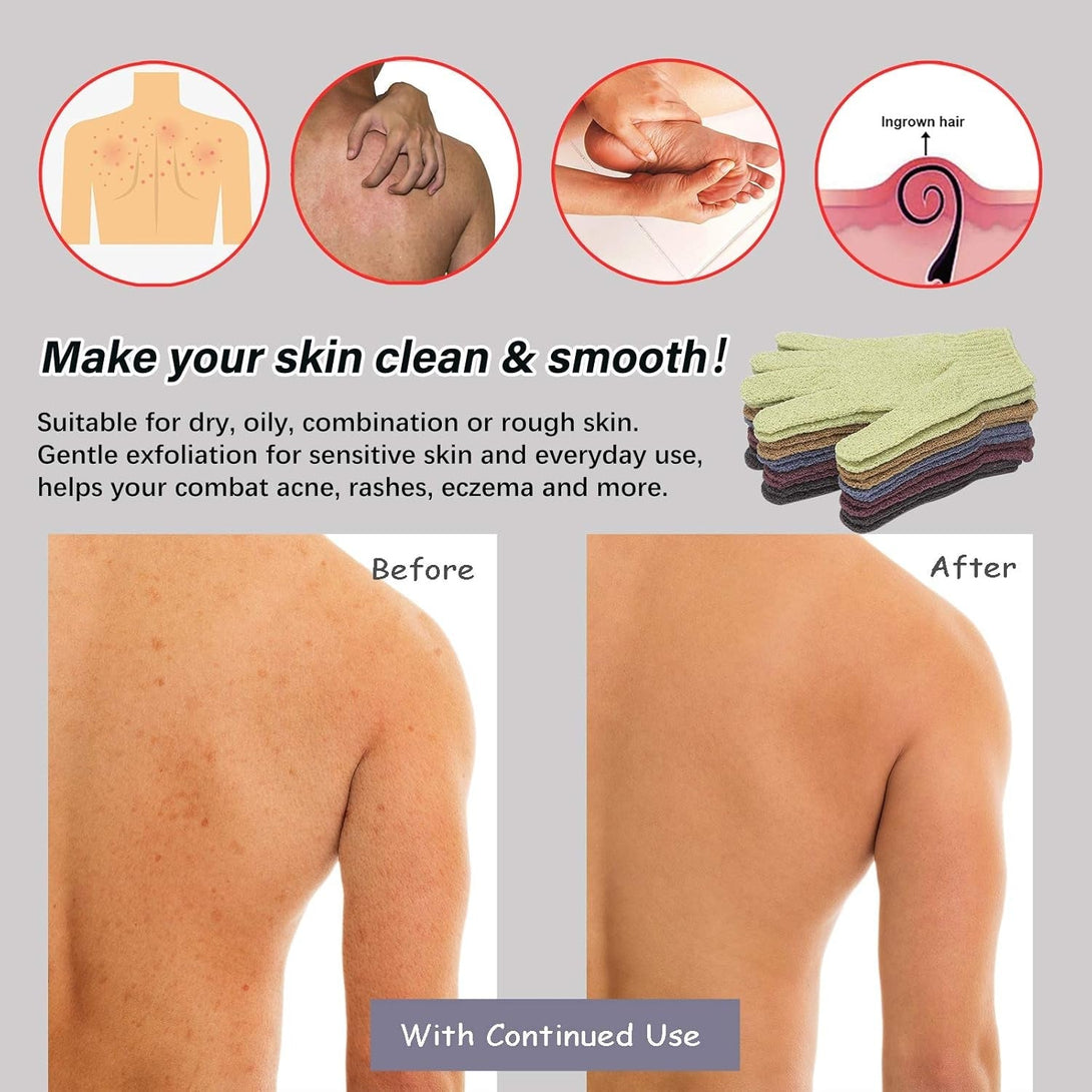 MIG4U Shower Exfoliating Scrub Gloves, Bathing Gloves Body Wash Dead Skin Removal Deep Cleansing Sponge Loofah for Women Men