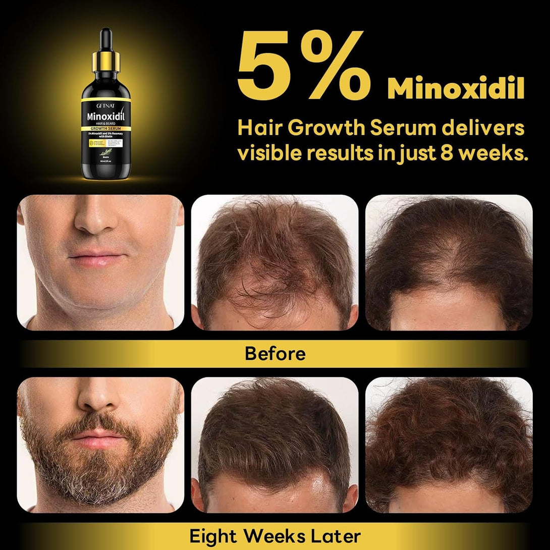 5% Minoxidil with Rosemary for Men and Women Hair Growth,Beard Growth Kit,Scalp Serum for Thicker Fuller Hair(2 X 2 Fl Oz)1