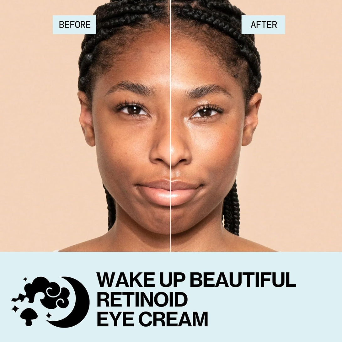 Pacifica Wake up Beautiful Retinoid Eye Cream – Anti-Aging under Eye Cream for Fine Lines & Wrinkles, Infused W/ Retinoid, Melatonin & Mushrooms for Puffiness, Dark Circles & Eye Bags Daily Treatment