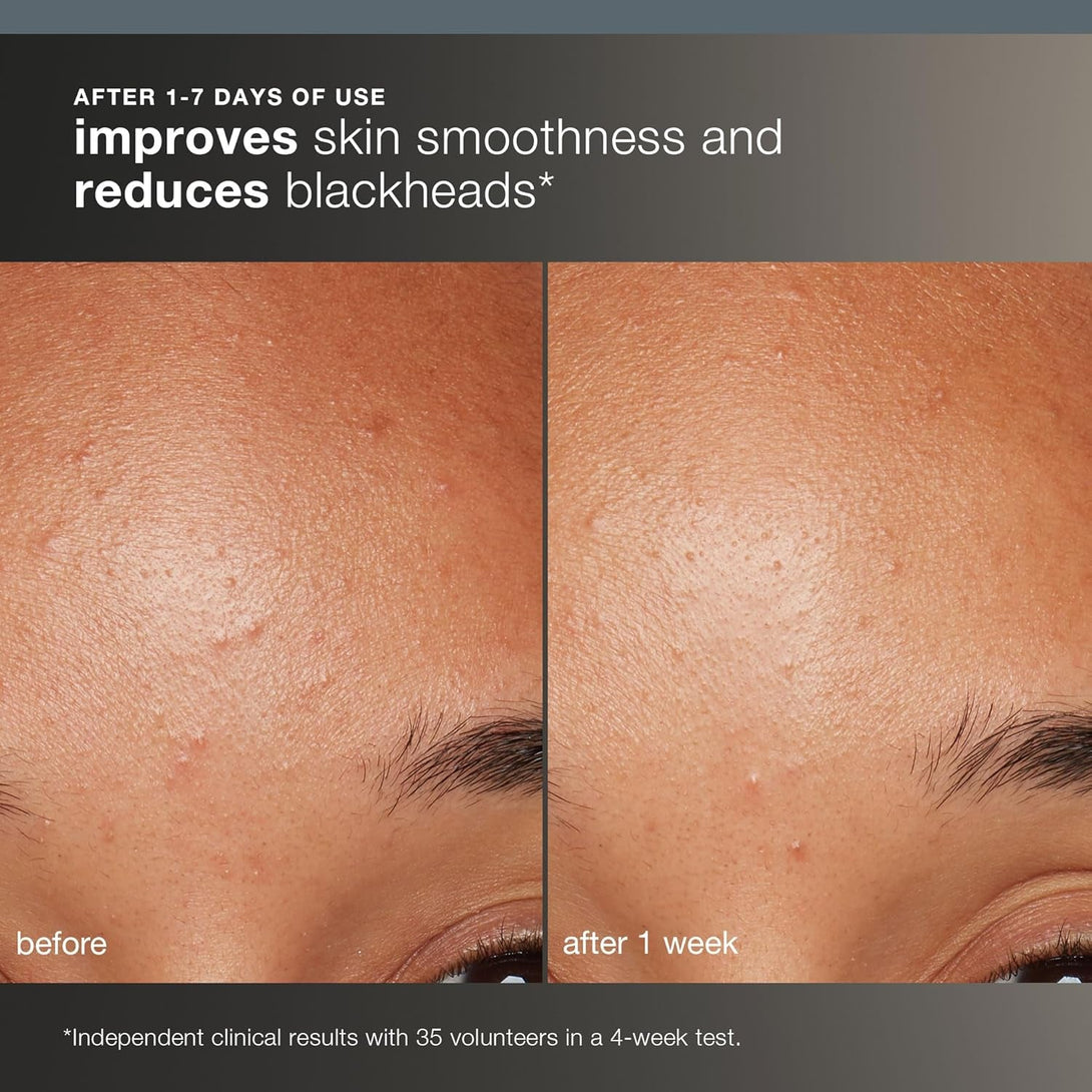 Dermalogica Daily Microfoliant, Face Exfoliator Scrub Powder with Salicylic Acid and Papaya Enzyme, Achieve Brighter, Smoother Skin Daily
