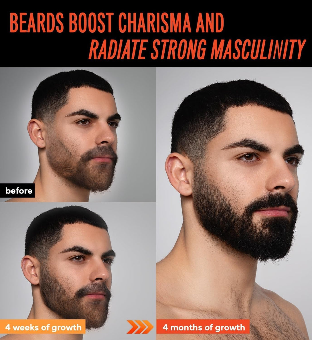 5% Minoxidil Beard Growth Oil for Men: Minoxidil for Men Beard Hair Regrowth Serum with Biotin and Caffeine - Unleash Your Wildness with Stronger Thicker Fuller Beard 2 FL Oz/60Ml