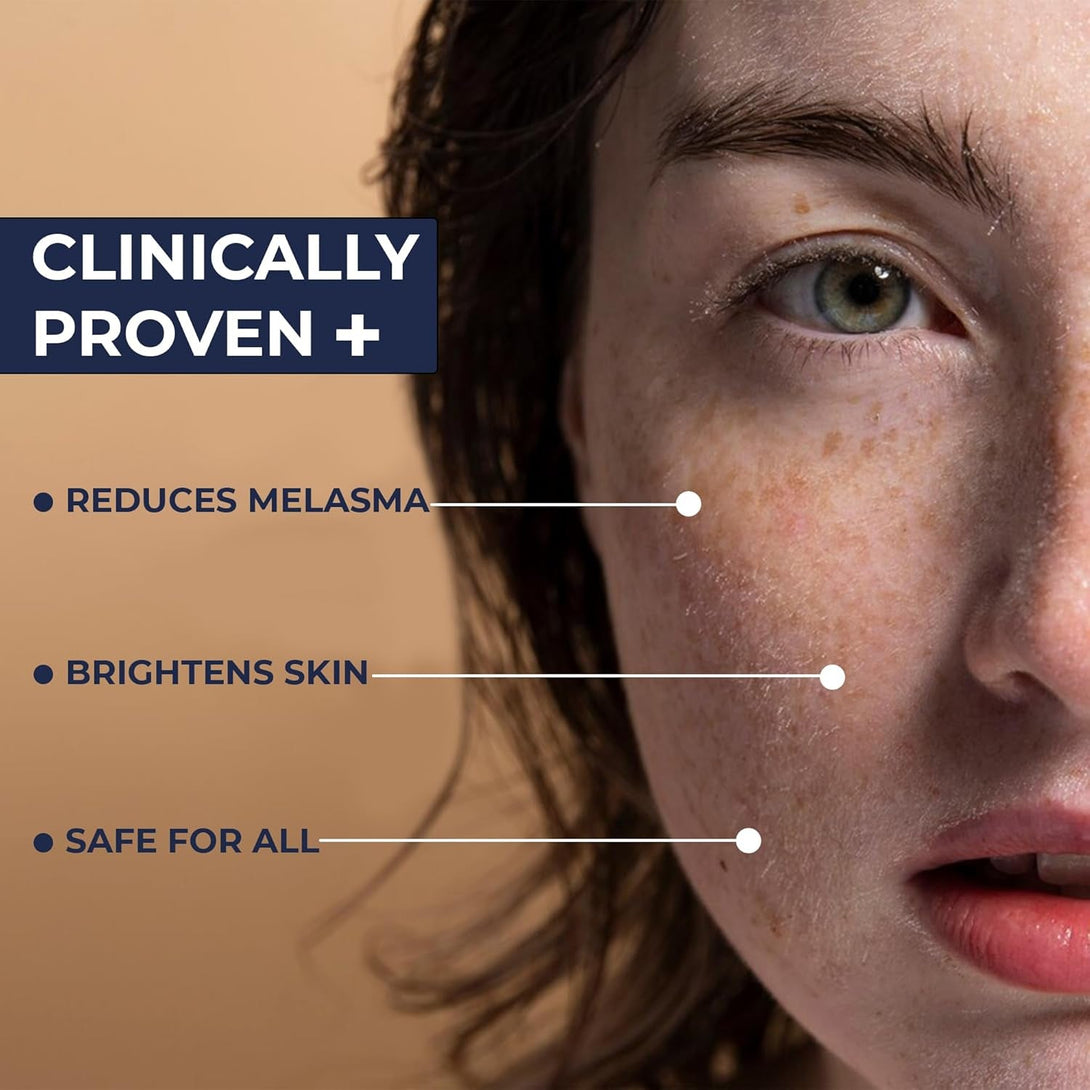 Melasma Treatment for Face - Melasma Cream & Age Spot Remover for Skin Discoloration, Post-Blemish Marks, Scars & Spots | Dark Spot Remover for Face & Body