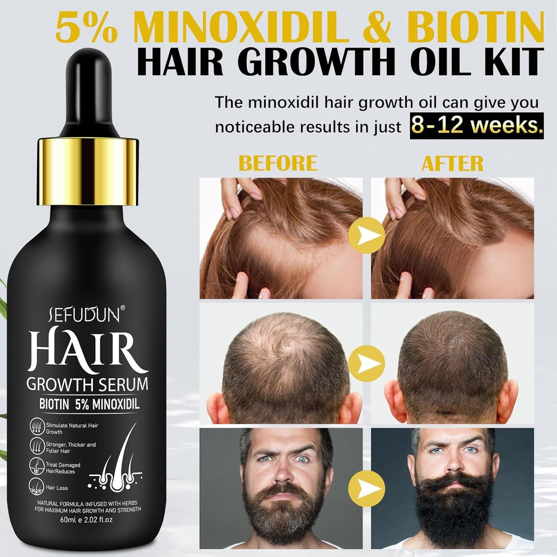 5% Minoxidil Hair Growth Oil for Men and Women - Regrowth Serum, Extra Strength Spray for Hair Loss, Thicker Healthier Hair, Beard Growth Kit, Topical Treatment, 2.02 Oz