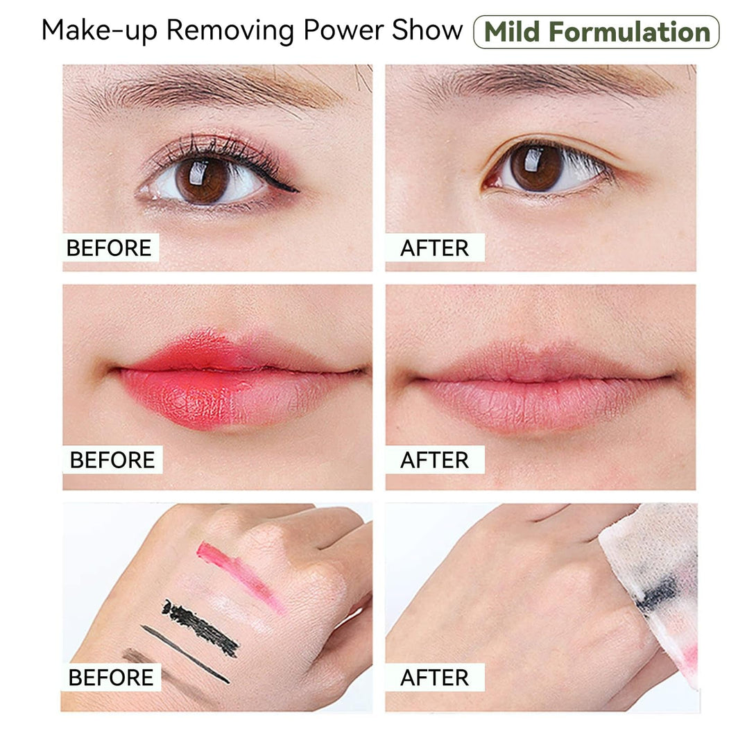 Hydrating Foam Cleanser | Makeup Remover & Gentle Face Wash for Normal to Dry, Sensitive Skin | No Fragrance, Non-Comedogenic, No Oil, No Soap (300Ml/10Oz)