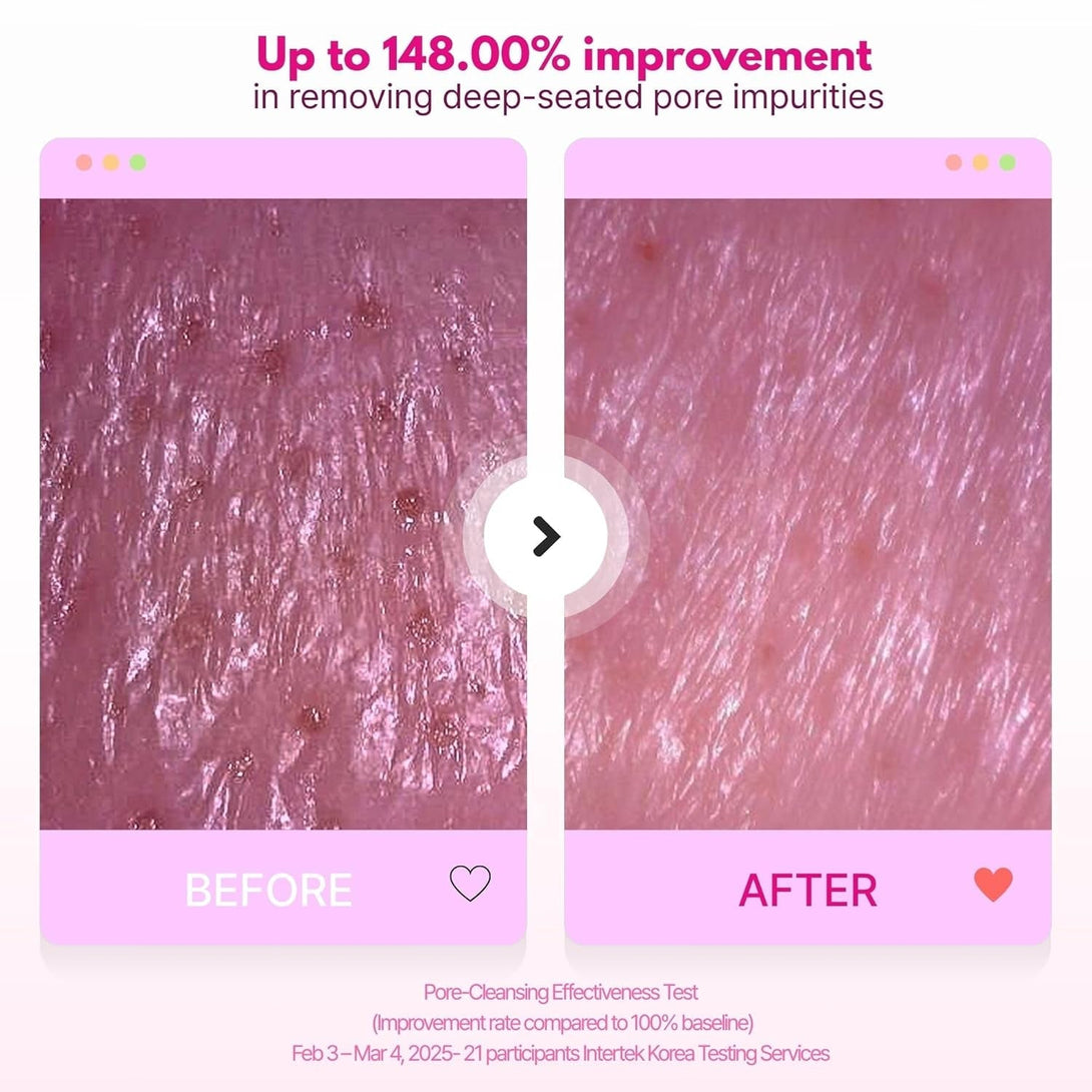 4-In-1 Konjac Jelly Face Cleanser – Gentle Daily Exfoliating, Deep Cleansing, Pore Care & Makeup Removal | Berry Smoothie Texture with Raspberry & Vitamin B+C+E Complex | Dermatologist-Tested
