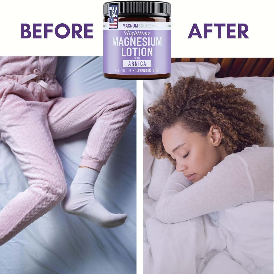 Nighttime Magnesium Lotion with Arnica – Soothing Relief & Relaxation, Highly Concentrated Magnesium for Muscles & Joints – Apply to Legs or Feet before Bed – Skin-Friendly