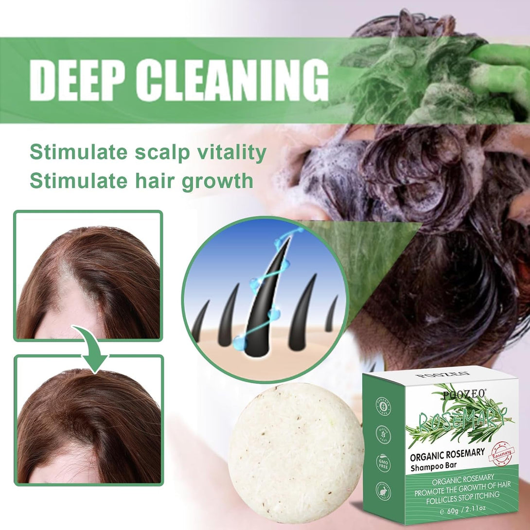 2 Pack Rosemary Hair Shampoo Bar,Deep Cleansing for Scalp Hair Loss Shampoo Soap,Organic Hair Oil Control,Solid Shampoo for Hair Growth, Refreshing and Hydrating Soap for Mothers Day Gifts