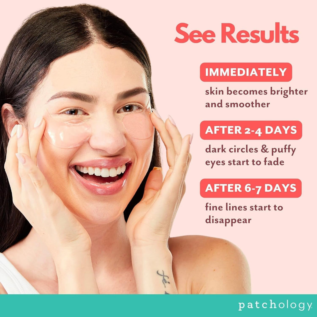 Patchology Serve Chilled Rosé Hydrating under Eye Patches – Hyaluronic Acid & Antioxidant-Infused Eye Masks to Reduce Dark Circles, Puffiness & Fine Lines - Ideal Skincare Essentials (5 Pairs)
