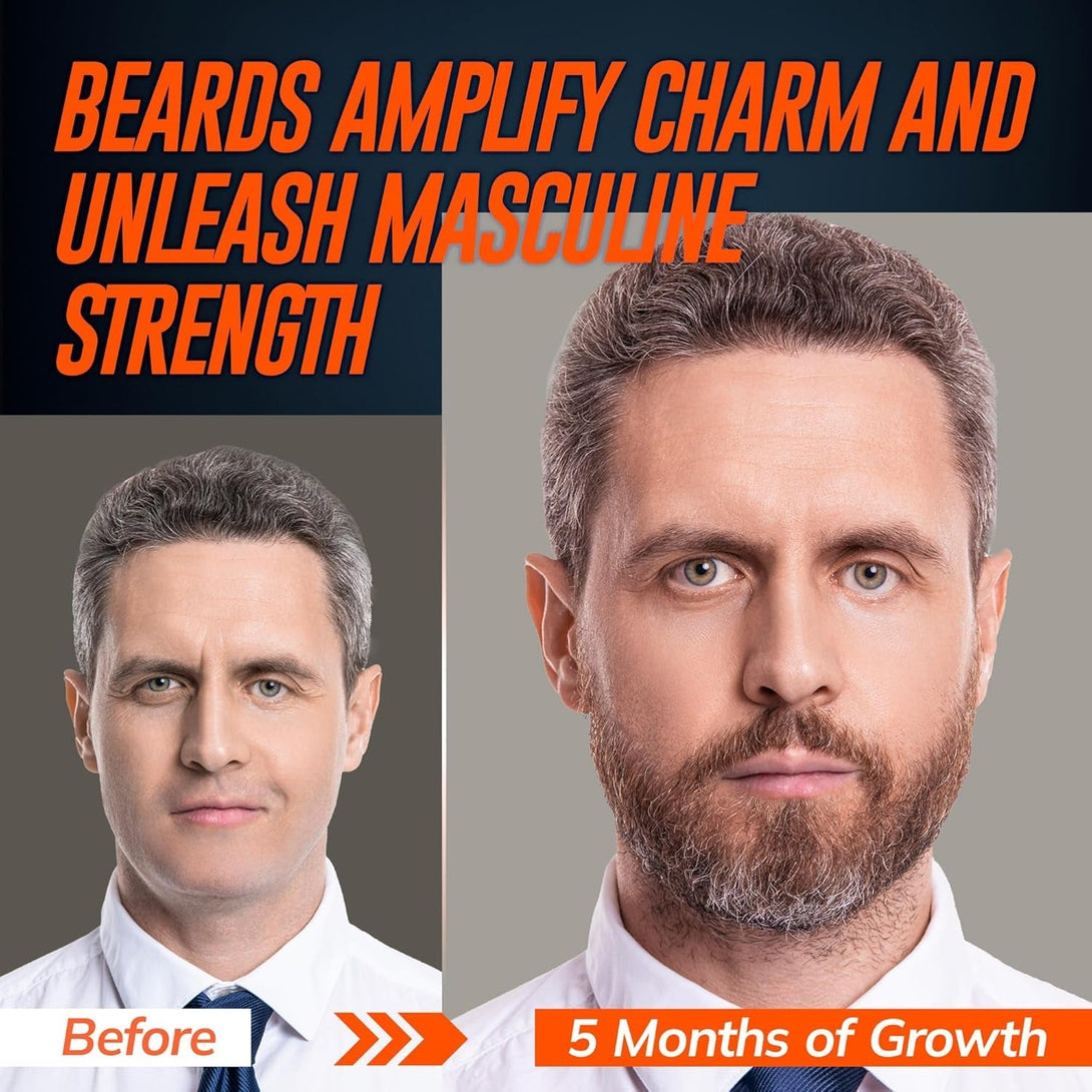 5% Minoxidil Beard Growth Serum for Men: 5% Minoxidil Hair Regrowth Spray with Biotin & Rice Water - Extra Strength Beard Oil for Faster Thicker and Fuller Beard Growth - 2.03 Fl Oz