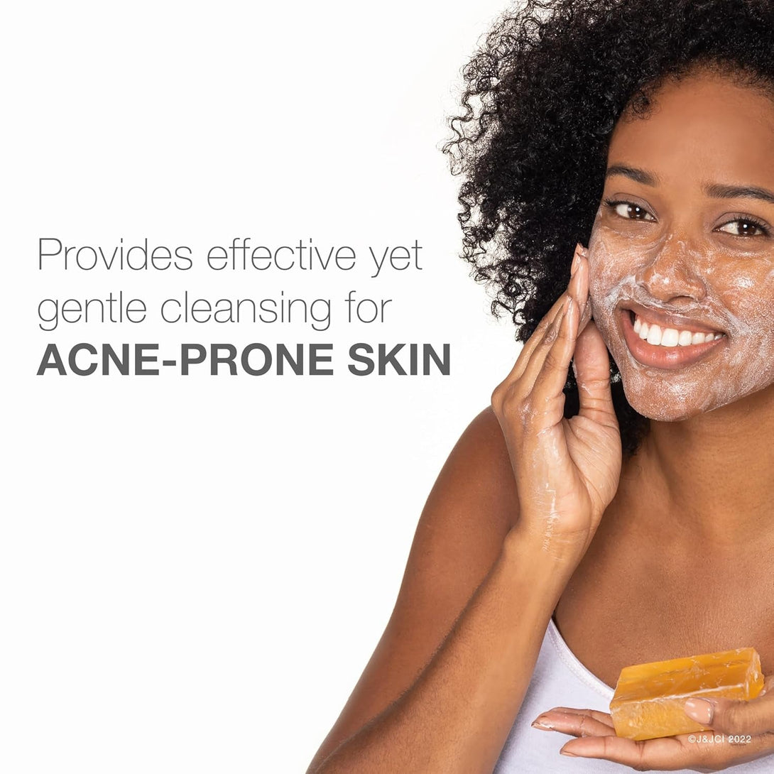 Neutrogena Facial Cleansing Bar Treatment for Acne-Prone Skin, Non-Medicated & Glycerin-Rich Formula Gently Cleanses without Over-Drying, No Detergents or Dyes, Non-Comedogenic, 3.5 Oz